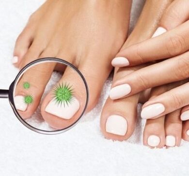 Infecção por unhas através de um luxo