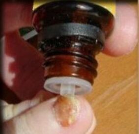 Aplicar gotas em uma unha afetada por fungo
