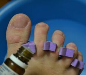 Preparando-se para tratar as unhas com gotas antifúngicas