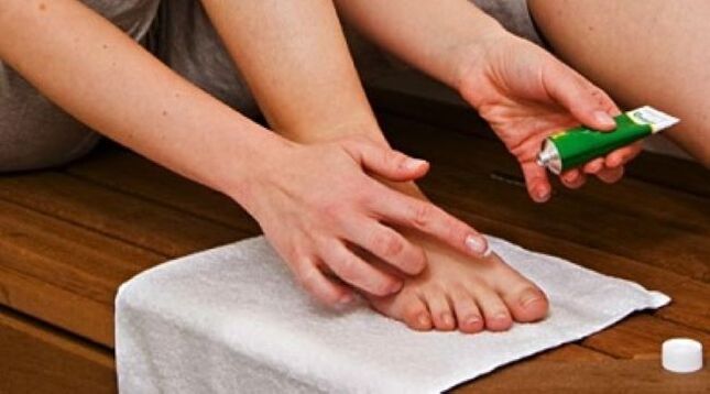 tratamento de fungo nas unhas com pomada